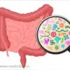 Elemental Diet: A Tastier Cure for Gut Disorders